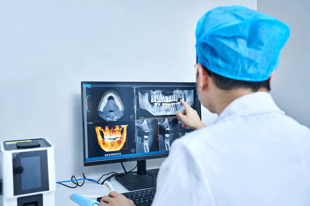 Best Emergency Treatment for Dental Infections or Abscesses in Coalinga, CA